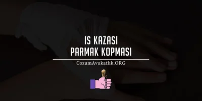 İş Kazası Parmak Kopması Tazminat