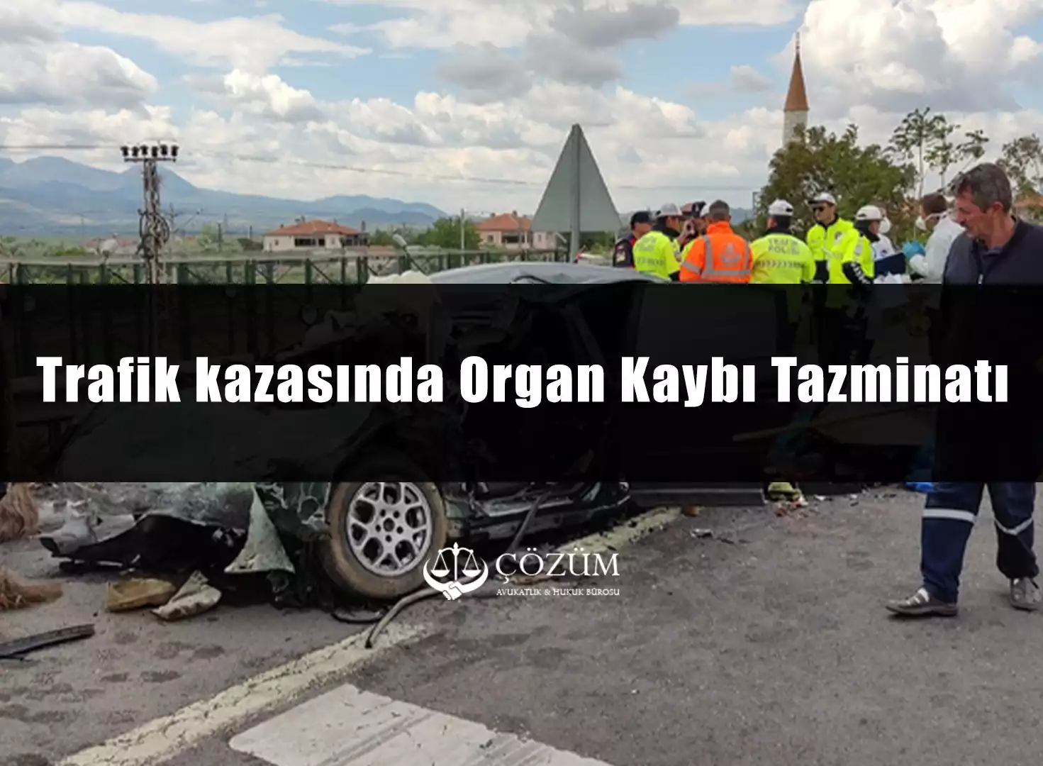 Trafik kazasında Organ Kaybı Tazminatı
