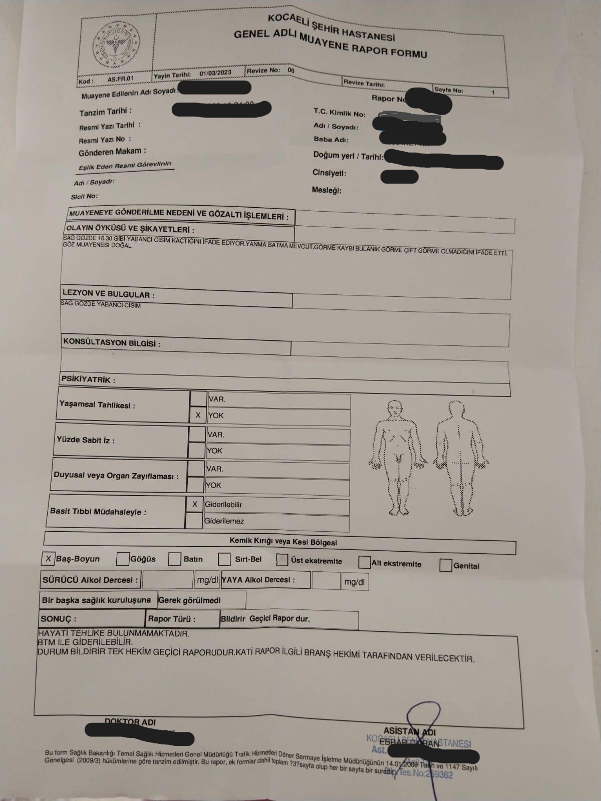 Acilde adli rapor örneği