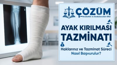 Ayak Kırılması Tazminatı