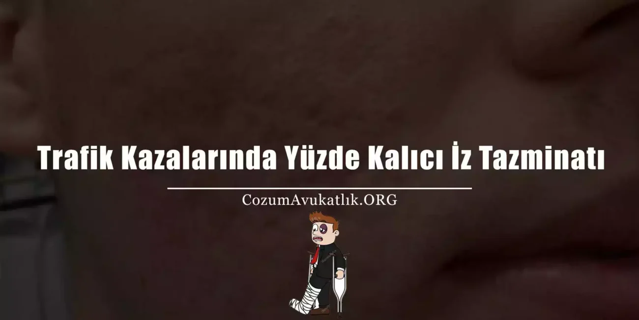 Trafik Kazalarında Yüzde Sabit İz Tazminatı